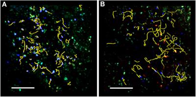 Live Imaging of Immune Responses in Experimental Models of Multiple Sclerosis